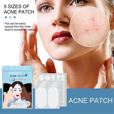 80pcs/Set Acne Acne Patch Large Size Acne Patch Hydrocolloid
