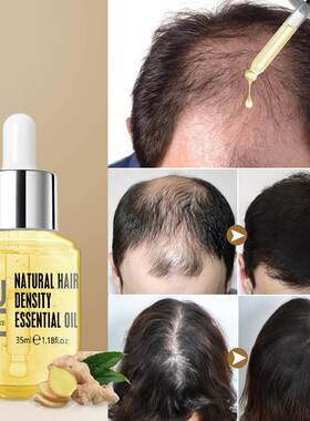 Ginger Hair Growth Products Prevent Hair Loss Essential Oil
