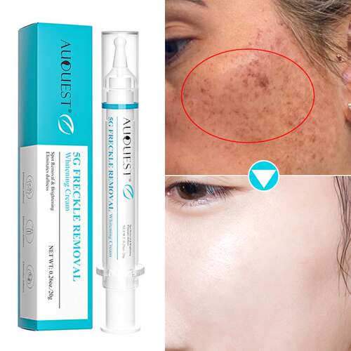 Dark Spots Removal Face Cream Dark Skin Whitening Moisturizi