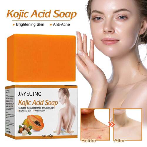 Kojic acid soap brightens skin tone, exfoliates and deeply c