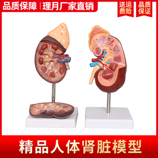 肾解剖模型标准人体肾脏肾上腺放大模型病变肾脏内脏器官医学教学
