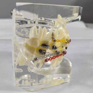 透明正畸撮合矫正模型透明水晶托槽展示结扎丝托槽正畸带支抗钉牙
