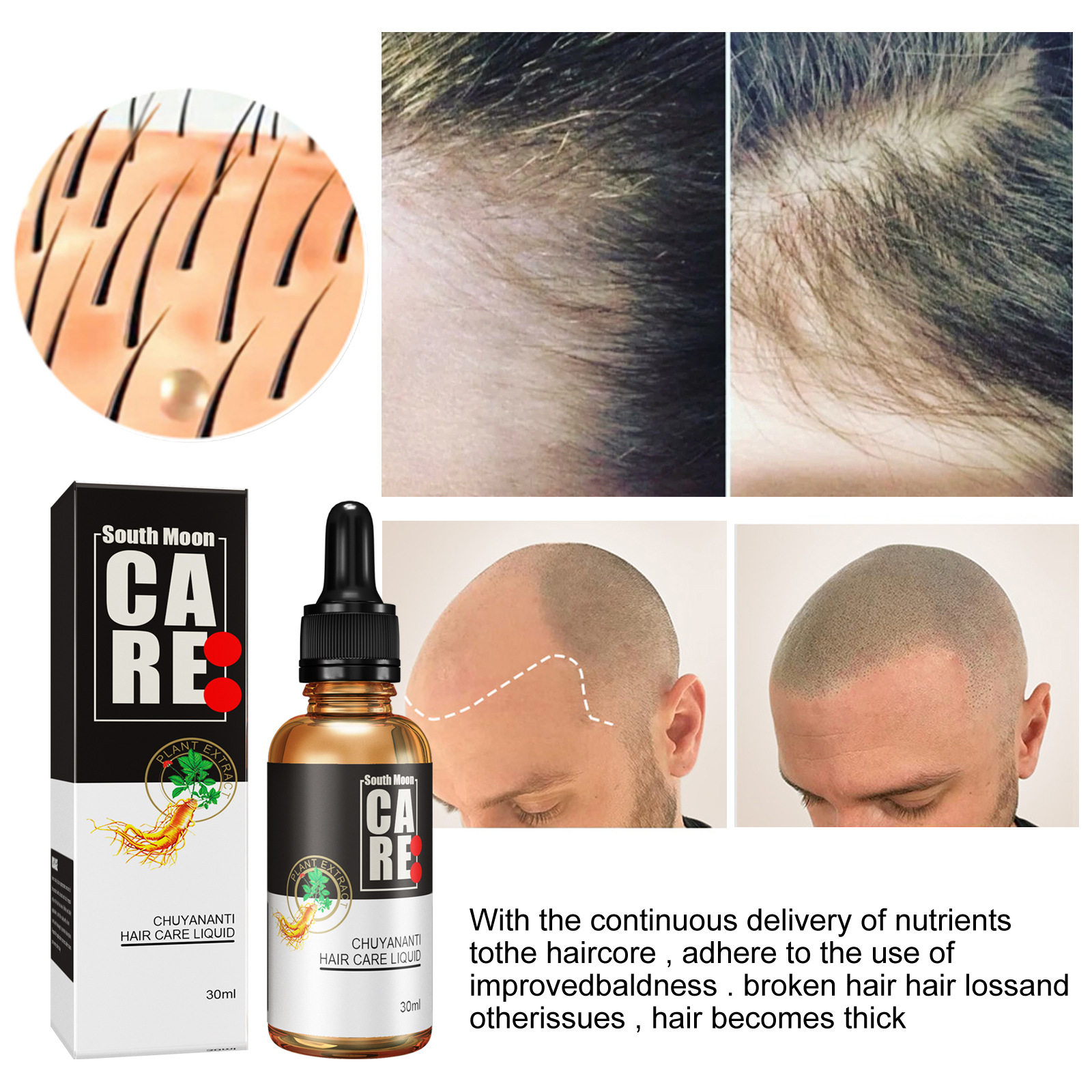Hair Growth Serum Scalp Treatment 30ml Formula - Product image 3