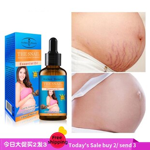 essential oil Stretch marks scar Pregnancy wrinkle补水提拉