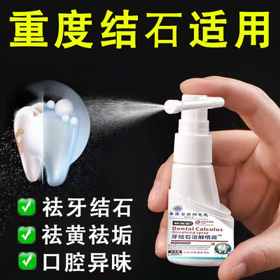 牙结石溶解剂洗牙齿污垢除口臭去黄美白洁离剂漱口水清洁神器喷雾
