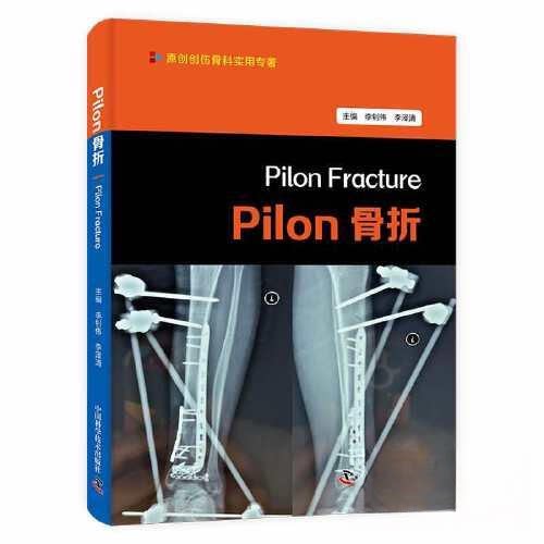 正版 PILON骨折 9787523600986 中国科学技术出版社