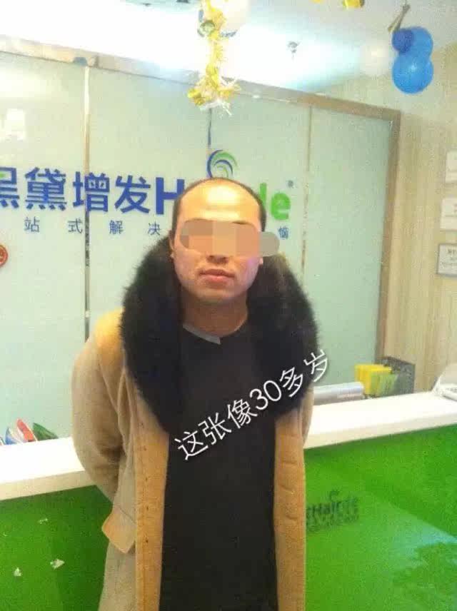 Extension mèches - Ref 224590 Image 3