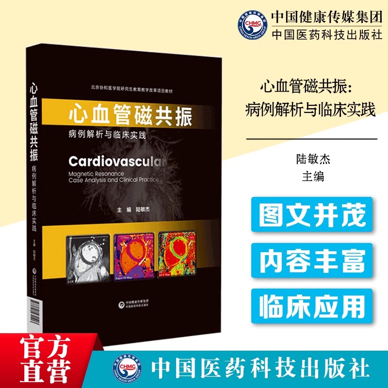 实用磁共振乳腺成像mri解剖学