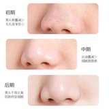 Носовые полоски от черных точек, мягкое средство для удаления прыщей подходит для мужчин и женщин, сужает поры, глубокое очищение, официальный продукт