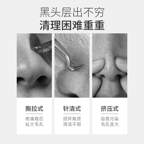 Носовые полоски от черных точек, мягкое средство для удаления прыщей подходит для мужчин и женщин, сужает поры, глубокое очищение, официальный продукт