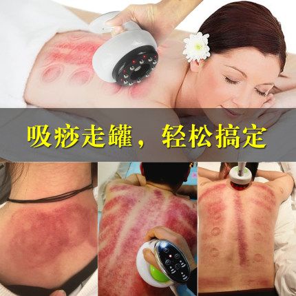 刮痧仪器电动吸痧机疏通家用淋巴经络全身拔罐电动发热加热走罐