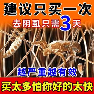 除阴虱灭头虱杀体虱卵几虮子的药原 二氯苯醚菊酯百灭宁扑灭司林