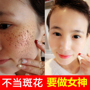 点斑水点遗传雀斑水美容院专用祛老年斑药水黑色素提取液取痣痦子