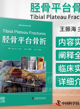 胫骨平台骨折 王振海 主译 国际经典骨科学译著 骨科学书籍 中国科学技术出版社 9787523606667