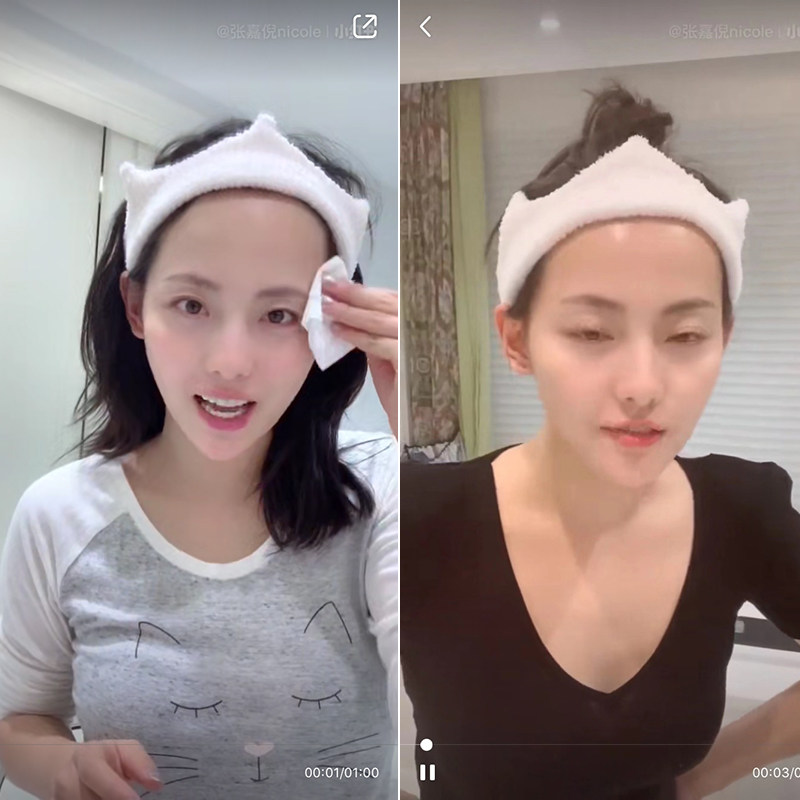 妻子的浪漫旅行皇冠张嘉倪发带