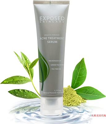 Acne Treatment Day Serum by Exposed Skin Care, 1.7 ounces