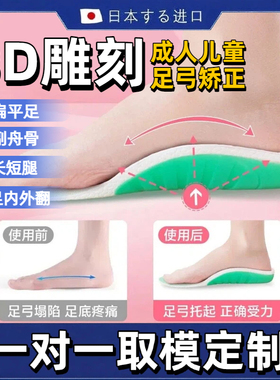 3d定制矫正鞋垫扁平足足弓支撑