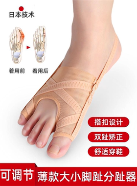 大拇指外翻矫正器分趾防磨