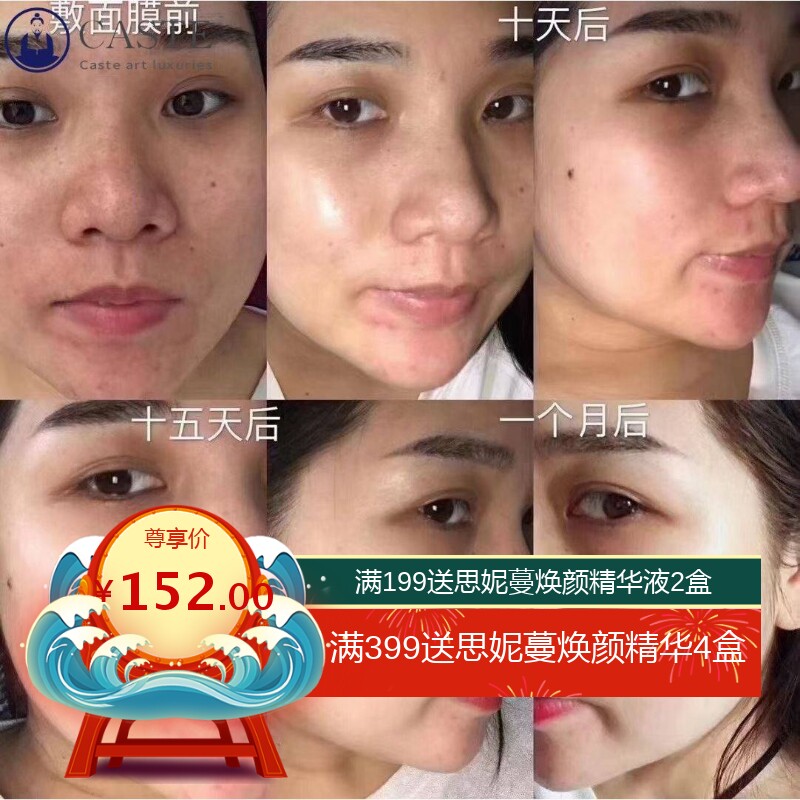 面部祛斑专用药水精华液真皮斑黄褐斑色素分解液排黑排色液溶斑油