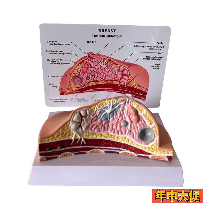 乳房模型乳腺增生家政培训妇产乳腺演示哺乳期乳房构造催乳师教具