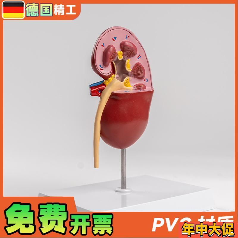 德国】病理肾模型 肾脏模型人体内脏模型自然大肾解剖附肾上腺模