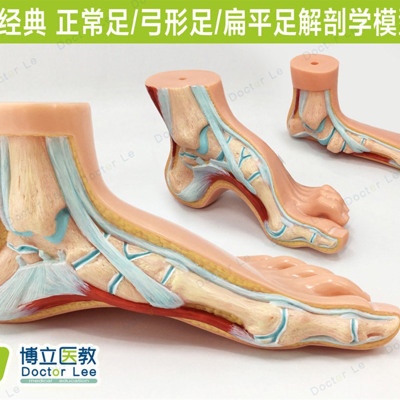 高端3款1:1足病m理对比扁平足 弓形足 健康足模型走路姿势矫正模
