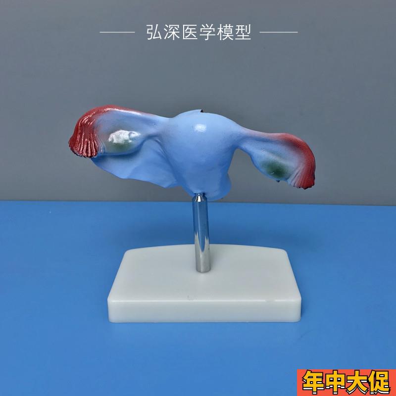 女性子宫模型人体生殖系统器官解剖卵巢输卵管妇产科医学教学模具