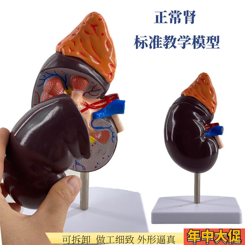 人体肾解剖模型2部件正常肾脏病理肾部模型专业内脏器官医学教具