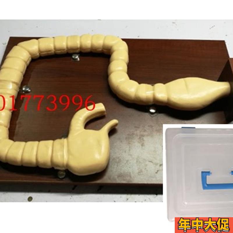 乙状结肠镜检查模型 大肠肠道病变模型