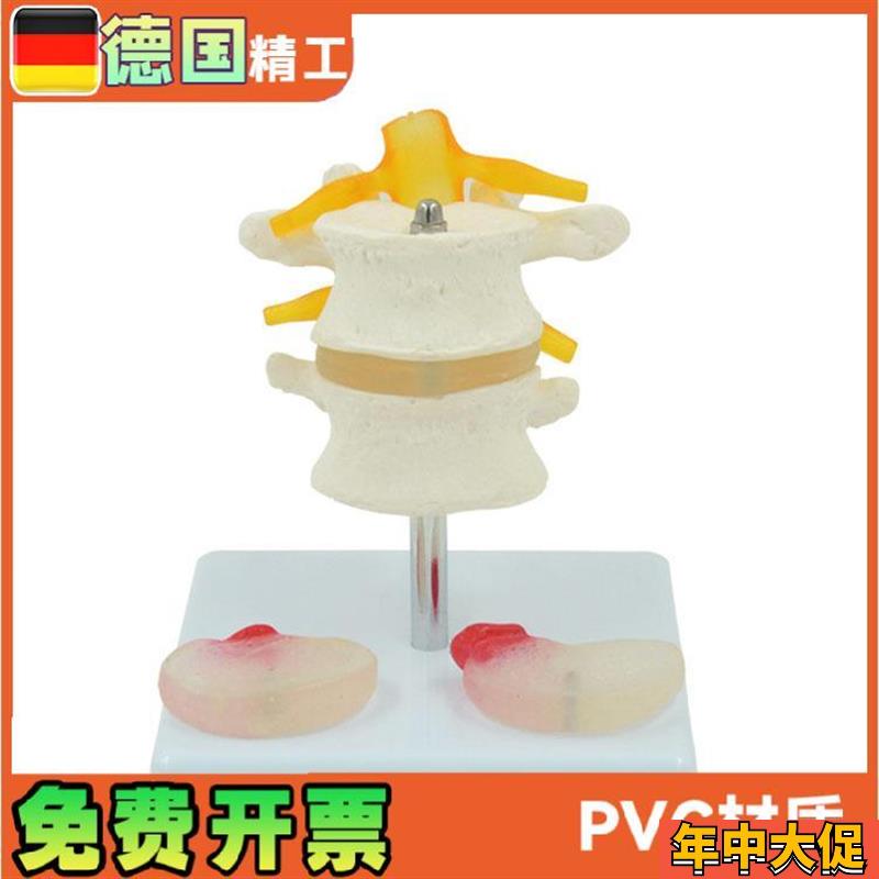 人体腰椎模型椎间盘脊神经根骨骼解剖医药礼品教学展示用道具