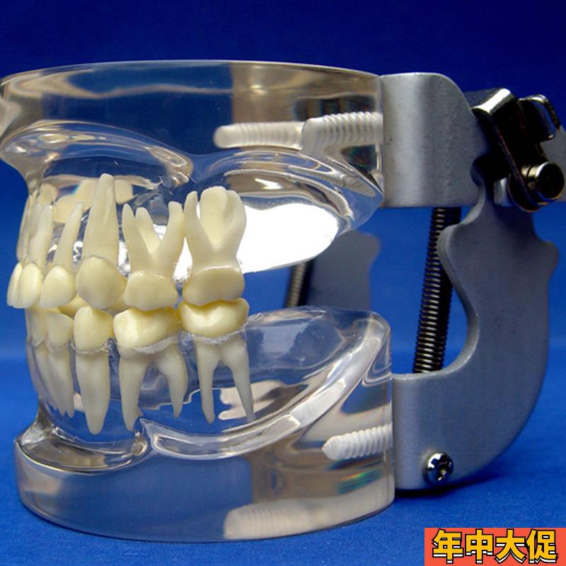 ENOVO颐诺儿童乳牙列模型儿童口腔教学展示模型牙科牙齿模型口腔