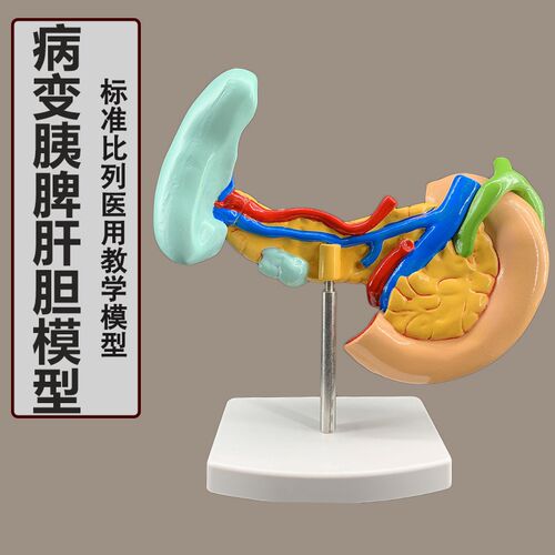 病变胰脾肝胆十二指肠模型u病理标本胰脾肝胆人体器官解剖教学模