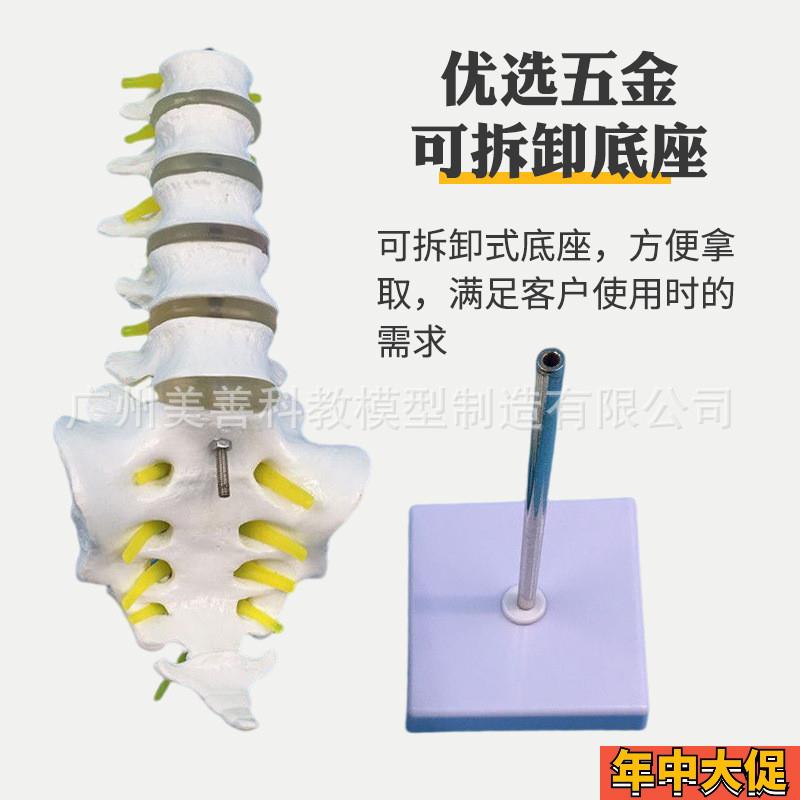 人体脊柱模型脊椎骨腰椎模型 腰椎结构腰椎间盘 关节模具病理腰椎