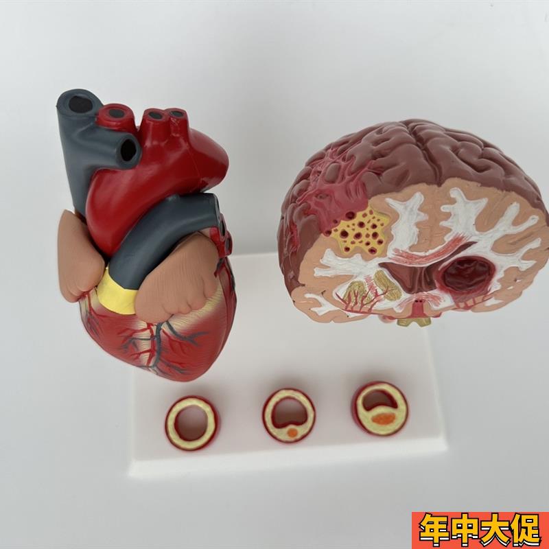 人体心脑血管展示模型血压高心脏模具与心血管模型 对比教具模型
