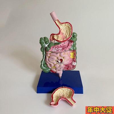 病理胃肠道模型 食管 大肠扭转梗阻 空回肠 消化系统医药促销礼品
