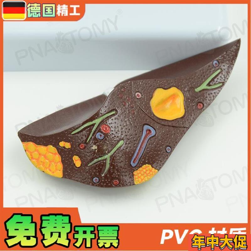 德国仿真医学病理肝脏解剖模型抽烟肝消化科教学标本肝胆保健模型