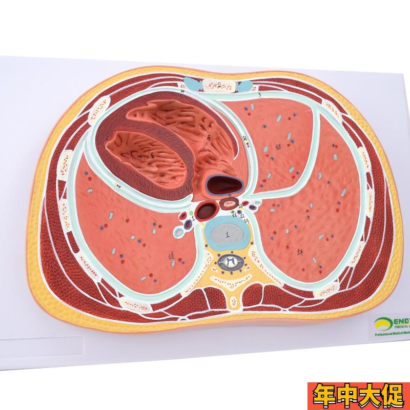 ENOVO颐诺人体胸腔横断模型CT