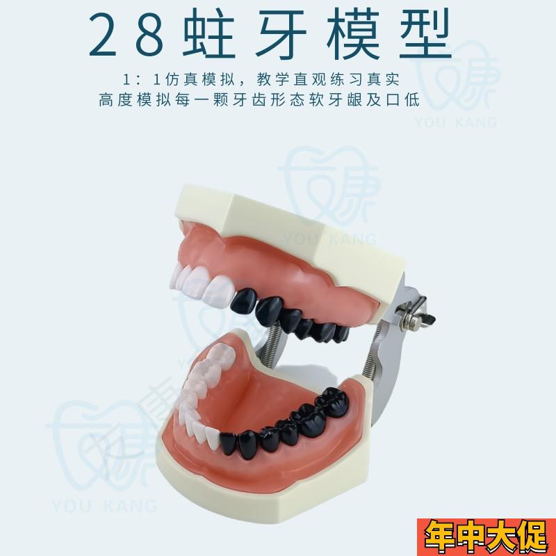 牙科全口可拆卸备牙模型  软牙龈模型 练习牙齿模型 送螺丝螺丝刀