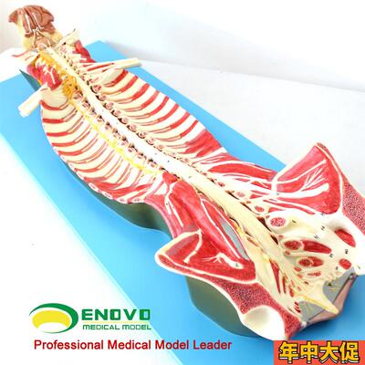 ENOVO颐诺 医学人体脊柱椎管解剖模型脊髓神经麻醉脊腰椎微创 骨