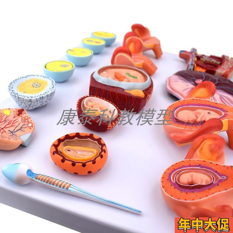 ENOVO颐诺人体髋关节股关节模型人体骨骼模型运动骨骨科科髋关节h