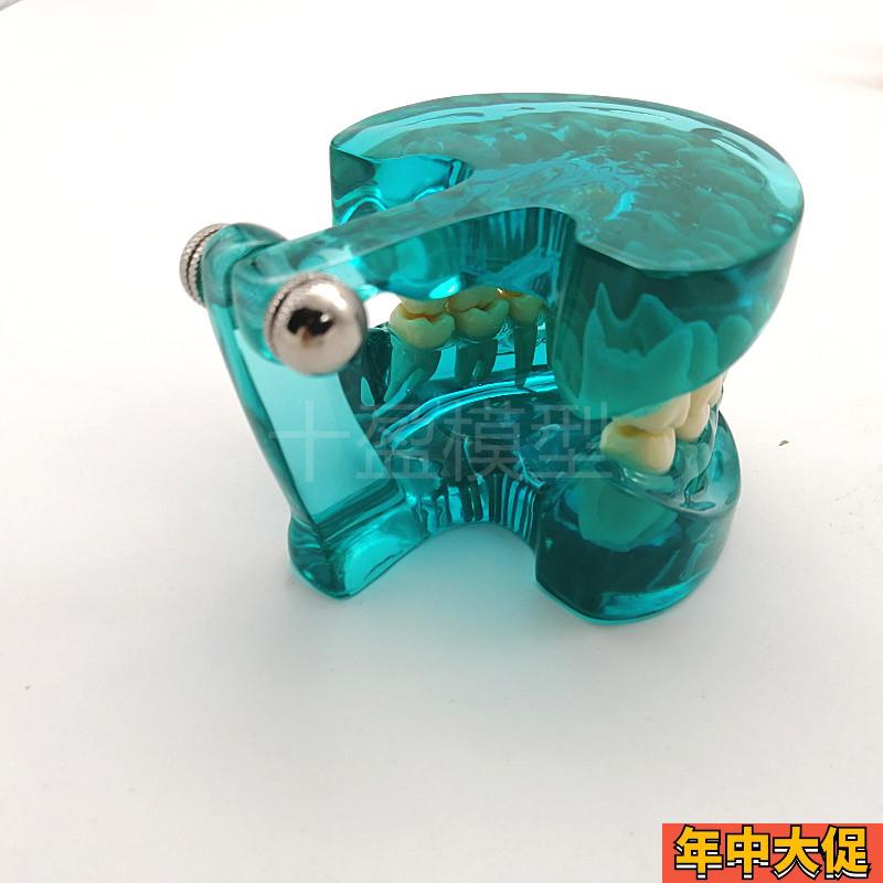 牙科口腔模型 新款标准牙齿透明水晶模型 全口28颗牙齿模型 包邮
