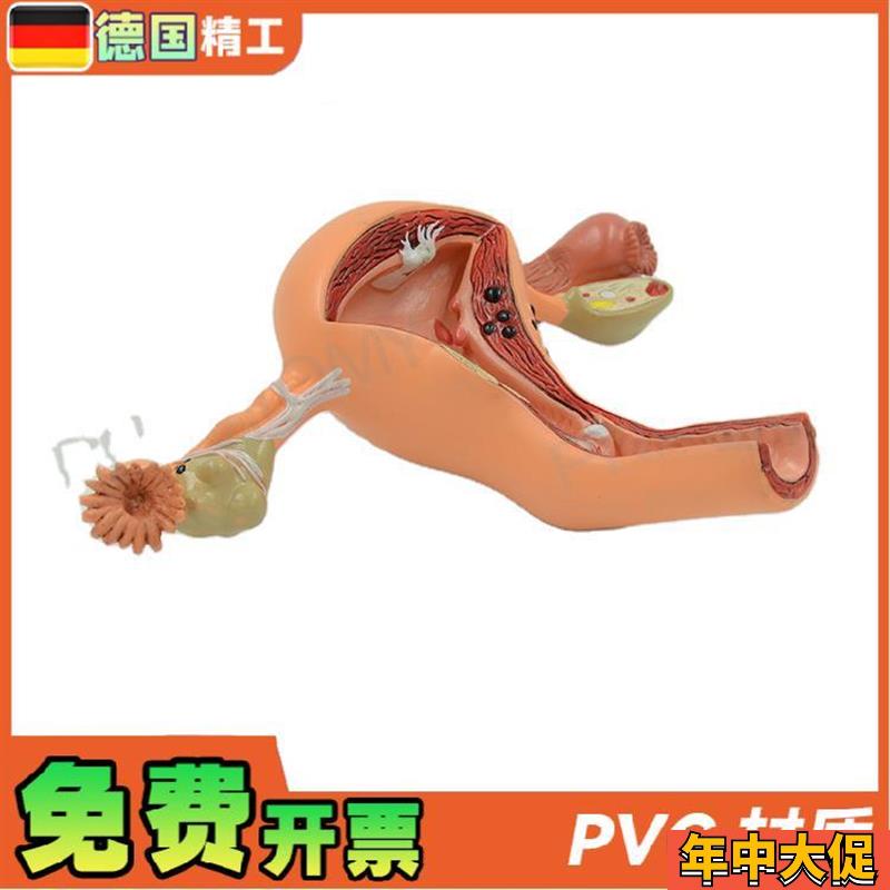 德国】女性子宫卵巢病理病变模型生殖科妇产科教学计生医学教学