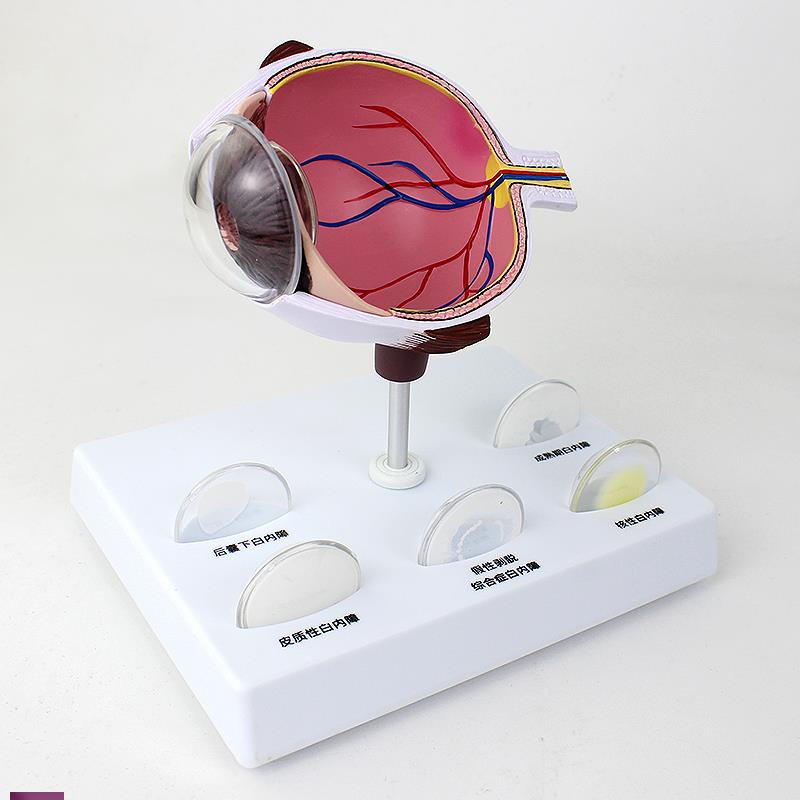 ENOVO颐诺人体眼球i白内障眼疾病瞳孔眼球体眼珠晶体医学教具白内