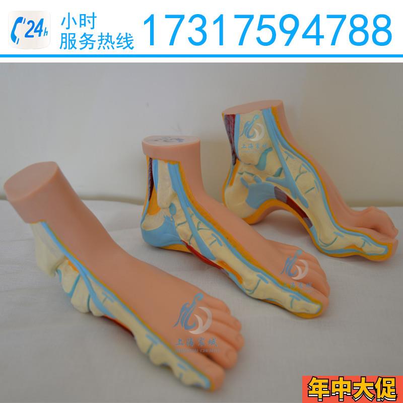 正常足扁平足弓型足模型