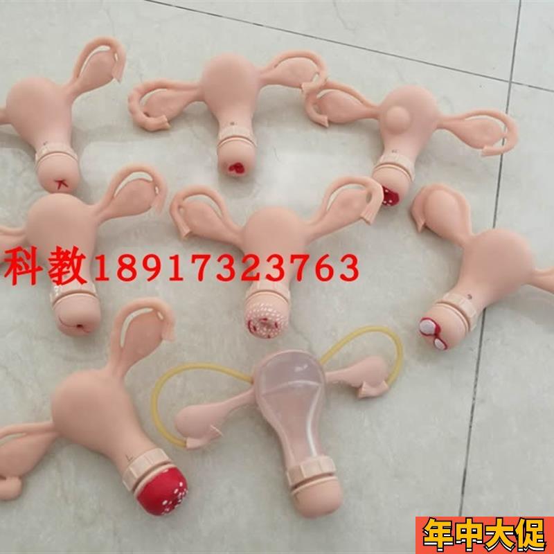 高级子宫宫颈病变模型(8件) 病理子宫对比教具模型
