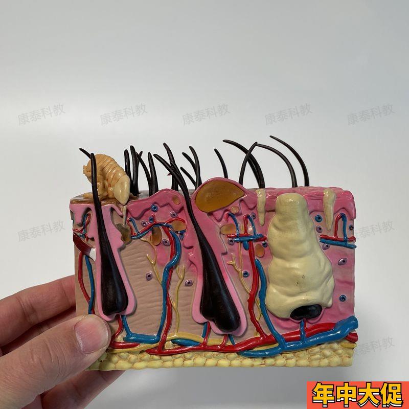 康泰动物模型犬皮肤螨虫跳蚤虫子叮咬病理脓疱宠物狗兽医药促销礼