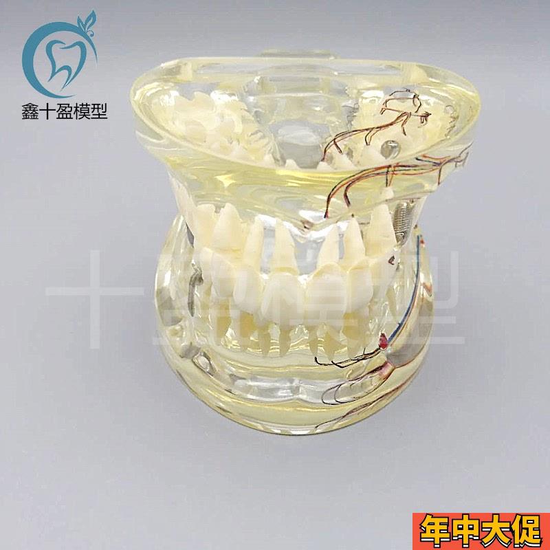 牙科水晶牙齿病理模型M4019-2成人透明病理牙模型 带牙神经和嵌体