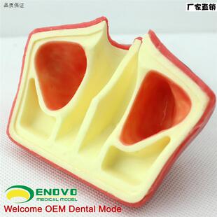 颐诺正品牙医口腔种植培训上颌骨上颌窦底提升术b操作模型牙齿科