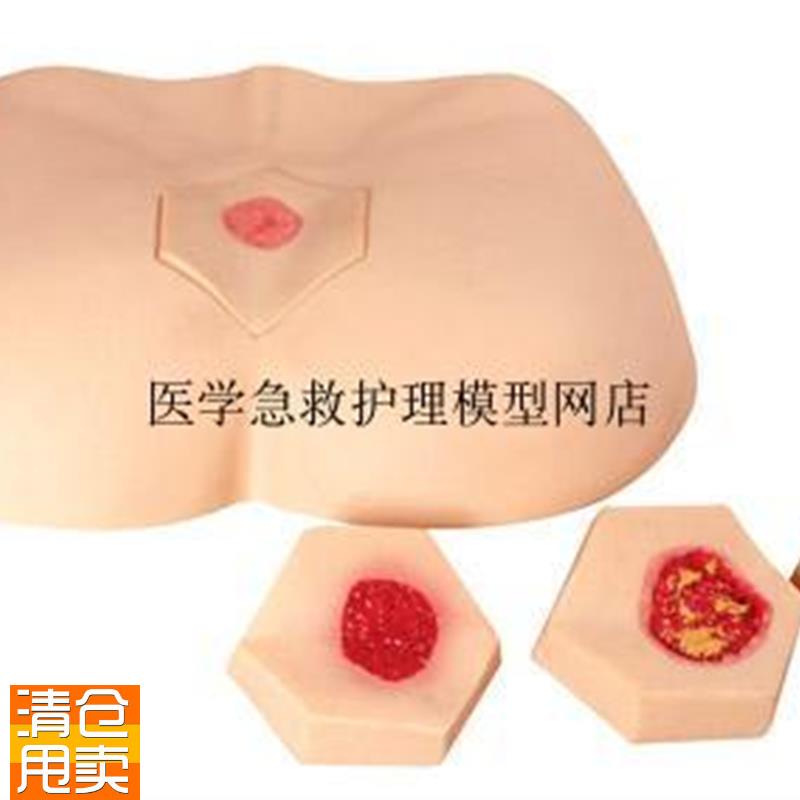 阶段褥疮护理模型护理操作不同阶段四个临床V分期成人臀部