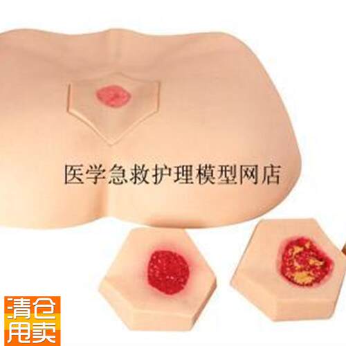 阶段褥疮护理模型护理操作不同阶段四个临床V分期成人臀部